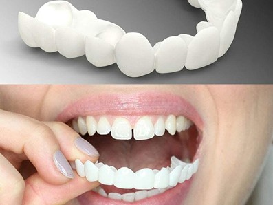 کامپوزیت متحرک دندان