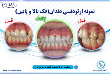 نمونه خدمات ارتودنسی دندان
